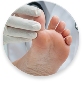 Athlete's Foot