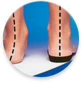 Flat Feet