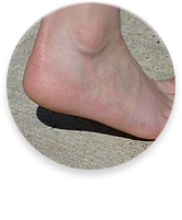 Heel Spurs