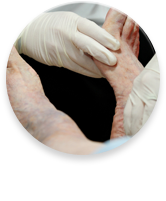 Neuropathy
